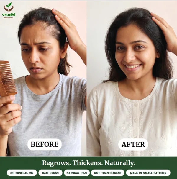 Hair Growth Oil - Image 9